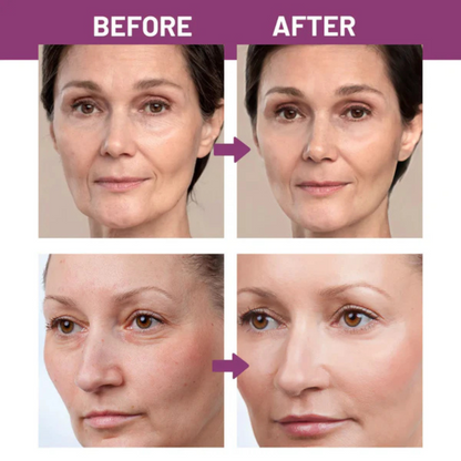 Calcium Lift Balm